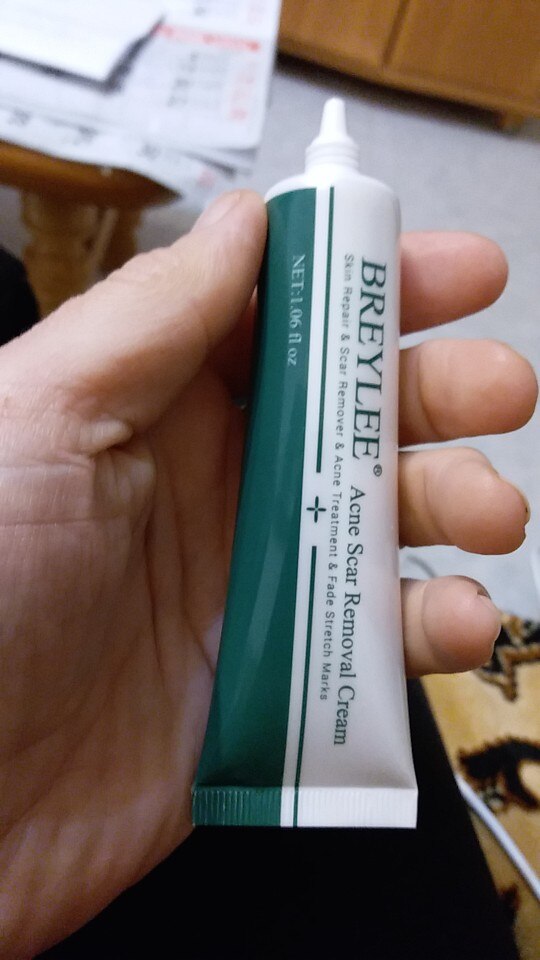 Scar Removal & Repair Cream for Smooth, Clear Complexion photo review