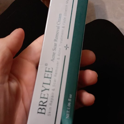 Scar Removal & Repair Cream for Smooth, Clear Complexion photo review
