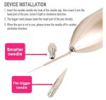 Skin Tag Remover Pen, Mole And Wart Removal