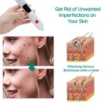 2 in 1 Dot Removal Pen for Removing Tattoos, Freckles, Skin Stains, Wrinkles, Plasma Pen For Skin Tags, Moles, Warts And Tattoos