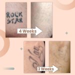 TatOFF 4 Weeks Tattoo Removal Cream